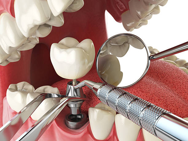 Best Emergency Cosmetic Dentistry (e.g., broken veneers) in Granite Quarry, NC